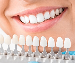 Closeup of teeth compared with color shading chart