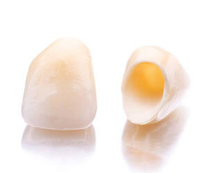 Dental crowns prior to placement