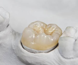 Model tooth with dental crown restoration