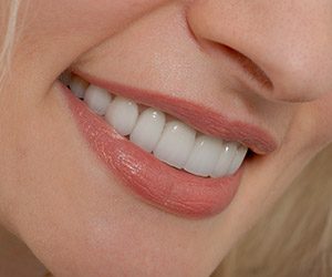 Closeup of healthy smile