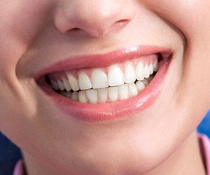 Closeup of woman with gorgeous smile