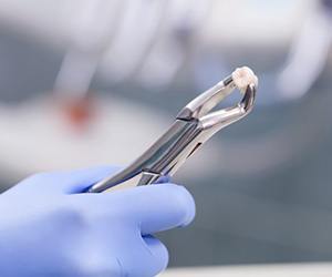 A dentist holding an extracted tooth.