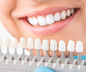 Shade guide next to white teeth